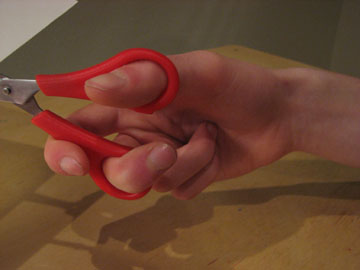 Palmar view of scissors
